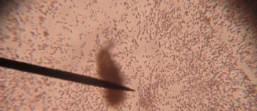 Bacillus F, la bactérie qui aide à vivre plus longtemps