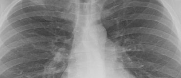 Conférences Rendez-Vous Carnot 2016 : Imagerie et robotique appliquées à l'urologie