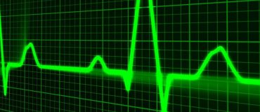 Cardiologs et le deep learning sur les électrocardiogrammes
