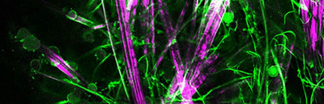 Le Deep learning en passe de devenir moins énergivore