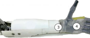 Une prothèse de bras qui décode les mouvements du membre fantôme