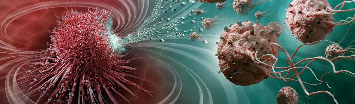 Une intelligence artificielle capable de détecter les tumeurs au cerveau en 90 secondes