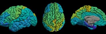 Cartographier les lipides du cerveau une nouvelle méthode d’IRM quantitative