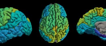 Cartographier les lipides du cerveau une nouvelle méthode d’IRM quantitative