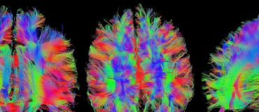 Un nouveau scanner médical issu de travaux sur la matière noire