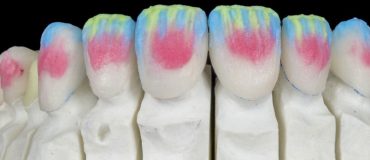 Une cuisson rapide des céramiques grâce à la technologie des micro-ondes à haute température