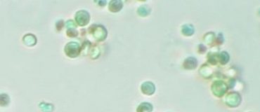 Fabriquer des bioplastiques grâce à la culture de microalgues