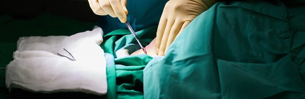 traitement, cancer, robot