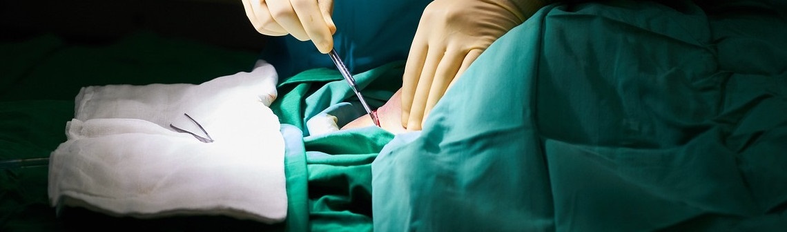 traitement, cancer, robot