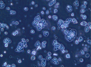 L’amibe Willaertia magna C2c Maky