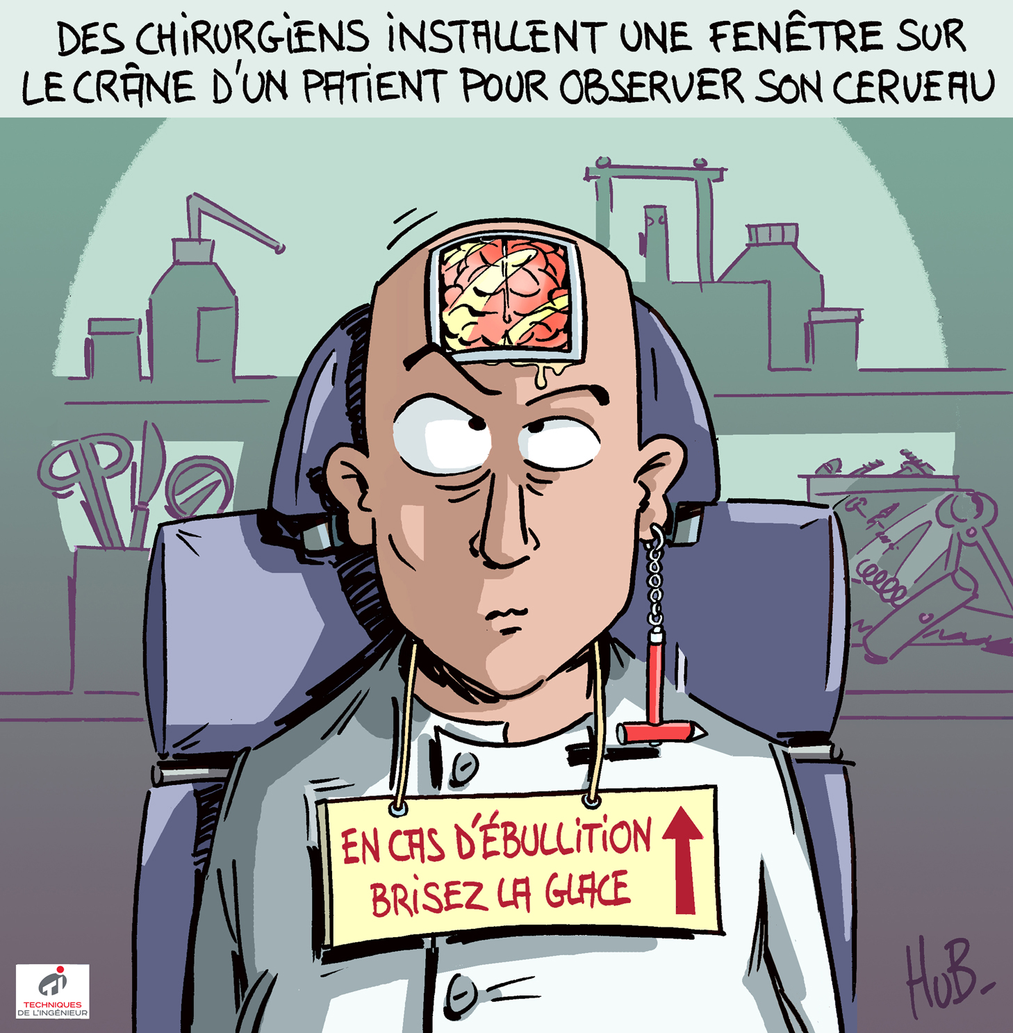 Des chirurgiens installent une fenêtre sur le crâne d'un patient pour observer son cerveau Des chirurgiens installent une fenêtre sur le crâne d'un patient pour observer son cerveau