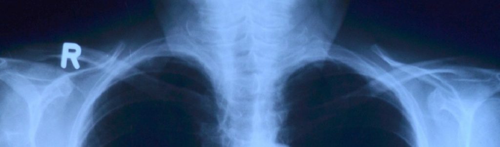 Raidium ou comment utiliser l’IA pour soutenir les radiologues