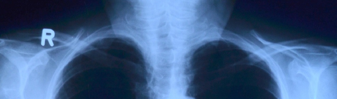 Raidium ou comment utiliser l’IA pour soutenir les radiologues