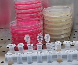 Spore.bio accélère les tests bactériologiques