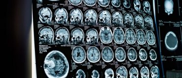 De la médecine à la bioinformatique, il n’y a qu’un pas… franchi par Élodie Germani