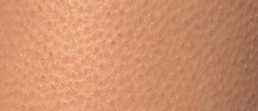 Un nouveau type d’hydrogel aux propriétés très proches de la peau humaine