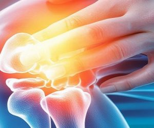 Un "cartilage artificiel" pour lutter contre l'arthrite