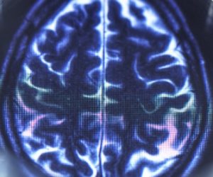 Ces nanofils révèlent les mystères des astrocytes