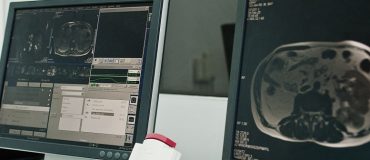 L'intelligence artificielle : le super assistant de la médecine