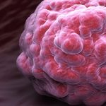 IA et recherche contre le cancer : six innovations inspirantes