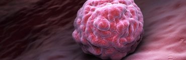 IA et recherche contre le cancer : six innovations inspirantes