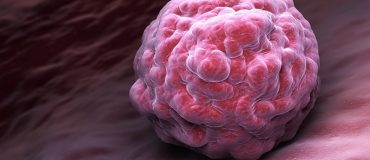 IA et recherche contre le cancer : six innovations inspirantes