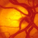 L’optogénétique ouvre la voie au contrôle des cellules par la lumière