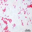 Les multiples visages de la bactérie Escherichia coli
