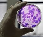 Grande première : des scientifiques japonais sont parvenus à reconstituer du tissu rénal
