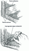 Figure 3 - GPA casting: the reaction spreads from the walls of the part to its center, which gels last.
