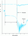 Figure 13 - Typical example of the measurement of a self-ignition delay τ defined from a pressure profile or the emission of species formed in the flame that originates as a result of phenomena that occur during the self-ignition delay (pre-ignition).