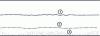 Figure 21 - Poincaré section in a plane perpendicular to the upper plane of figure 19 in ...