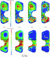 Figure 50 - Mapping of dimensional deviations between blown body and theoretical definition for different demolding temperatures