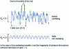 Figure 39 - Example of pressure fluctuation recording