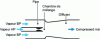 Figure 24 - Schematic cross-section of a steam ejector