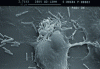 Figure 4 - Pseudomonas aeruginosa aggregate on a pneumocyte (doc. UMR 6270 CNRS)