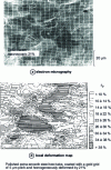 Figure 29 - Local heterogeneity of tensile strain 