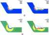 Figure 14 - Filling a pit [(a) proportions of "untempered" martensite, (b) longitudinal stress] (courtesy of Framatome ANP)