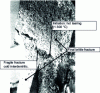Figure 14 - Interdendritic brittle fracture