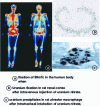 Figure 5 - Heterogeneous distribution of radionuclides after incorporation, at body, tissue and cellular levels