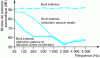 Figure 12 - Noise reduction with NoiseMaster™ headphones (TechnoFirst doc.)