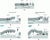 Figure 14 - Paint corrosion mechanisms: (a) galvanic coupling due to an initial defect in the paint film, (b, c) blistering propagation in the case of an active defect, (d, e) filiform corrosion propagation in the case of a partially passivated defect.