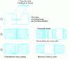 Figure 7 - Fiberglass-reinforced plastic (FRP) pipe splicing