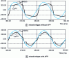 Figure 21 - TGV-Atlantique – Waveforms mixed bridges with and without AFP