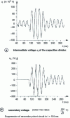 Figure 32 - Capacitive voltage transformer with anti-ferroresonance device: response on opening