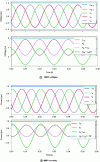 Figure 14 - Typical waveforms of an MMC