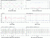Figure 17 - Simulation results for a 20° phase shift on the MMC#1 side at t = 1 s