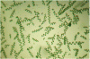 Figure 2 - Spirulina (source: French Spirulina Producers Federation)