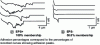 Figure 8 - Force curves obtained by force spectroscopy: (a) with cells producing EPS (EPS+) and (b) with cells not producing EPS (EPS-) (adapted from [11])