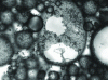 Figure 7 - Optical microscopy image of a stable Pickering H/E emulsion showing partial coverage of silicone oil droplets by solid ZnO particles.